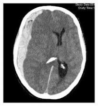 brain_fluids