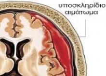 subdural_hematoma